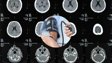 Common Blood Pressure Drug Hydralazine Could Slow Down Cancer