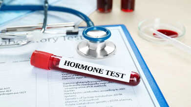 hormonal imbalance test