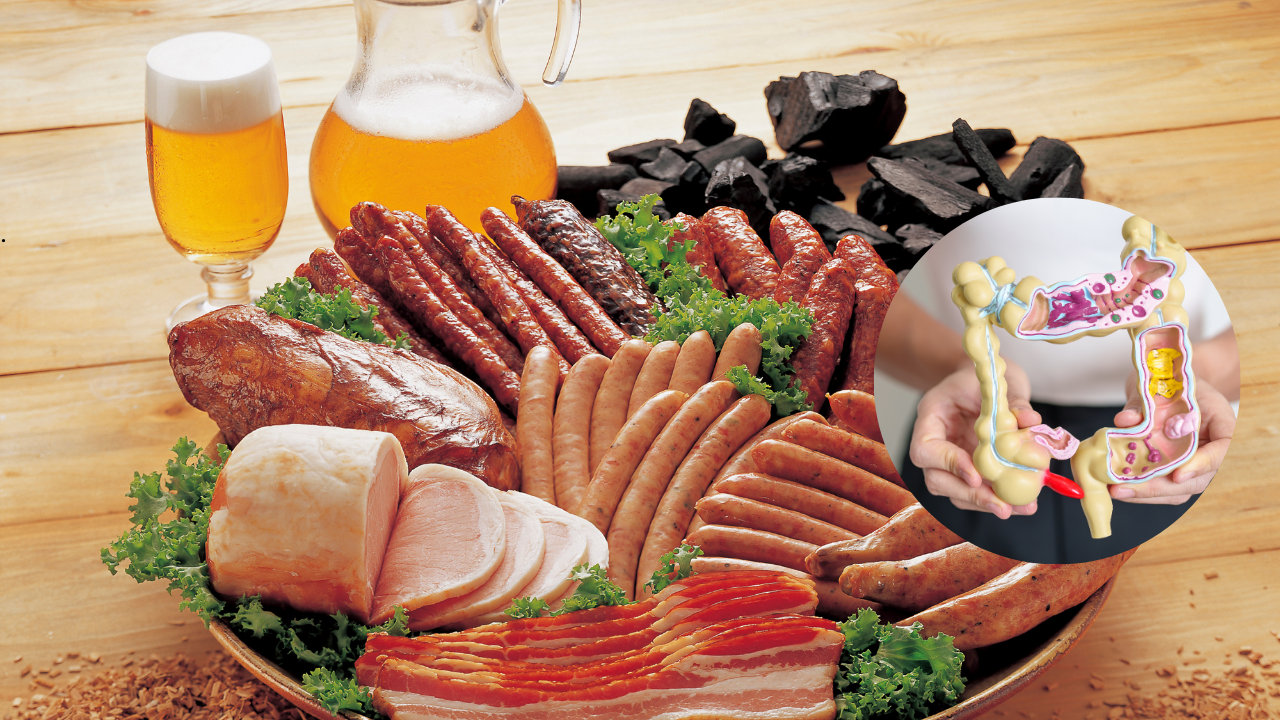 After Lancet Links Ultra-Processed Foods to Organ Damage, New Study Ties Them to Bowel Polyps in Women Under 50