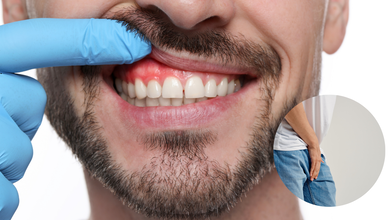 Can A Gum Disease Lead To Erectile Dysfunction? Here's What New Evidence Shows
