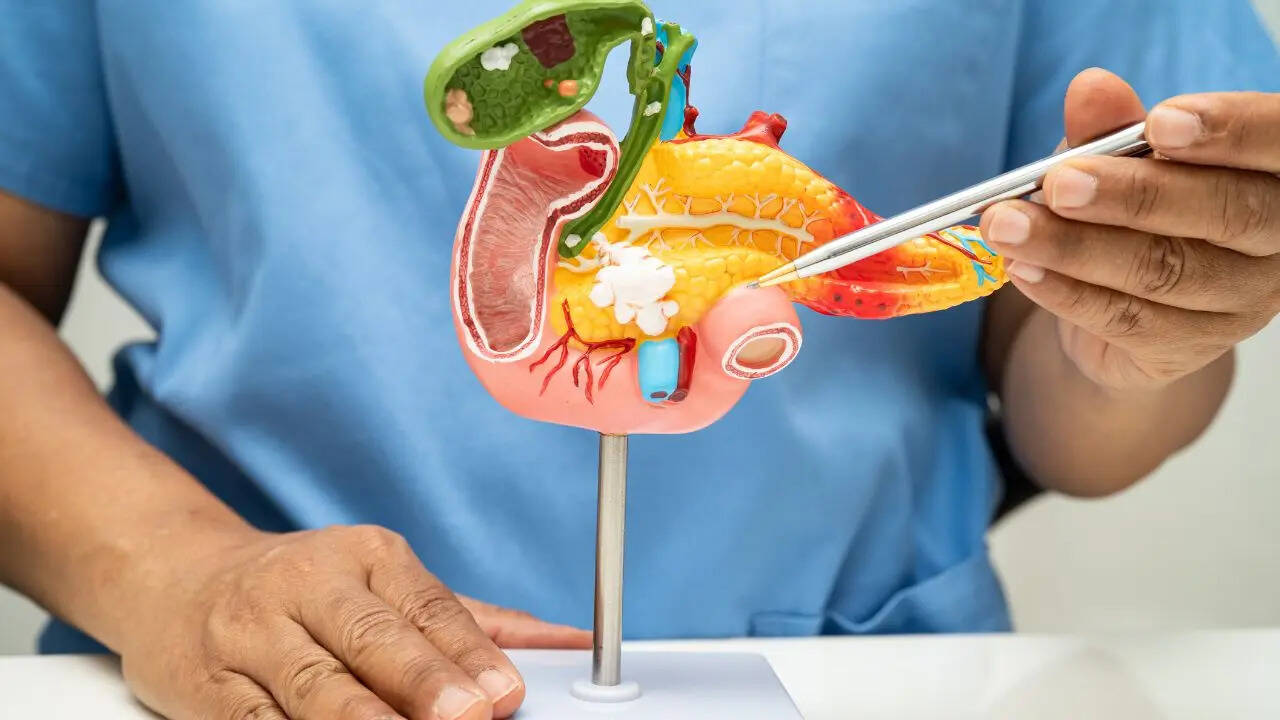 pancreatic cancer symptoms