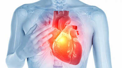 winter pollution chest pain