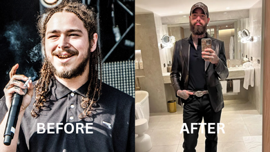 How Post Malone Lost 55lbs Just By Cutting Soda And Ditching Junk