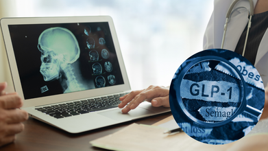 GLP-1 Drugs Don’t Just Curb Appetite; They Rewire the Brain, Shows Study