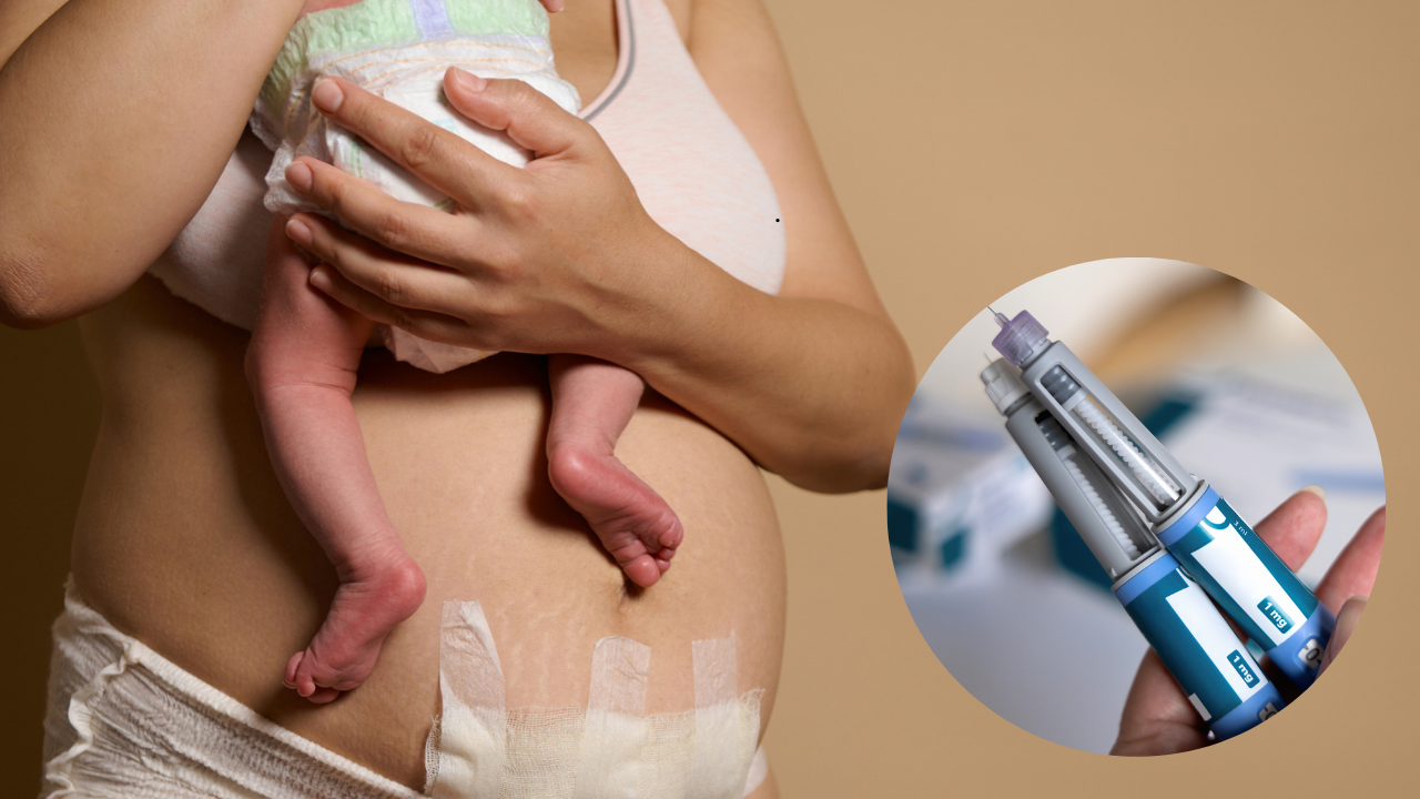 More New Moms Turning to Ozempic After Birth, But Experts Are Worried