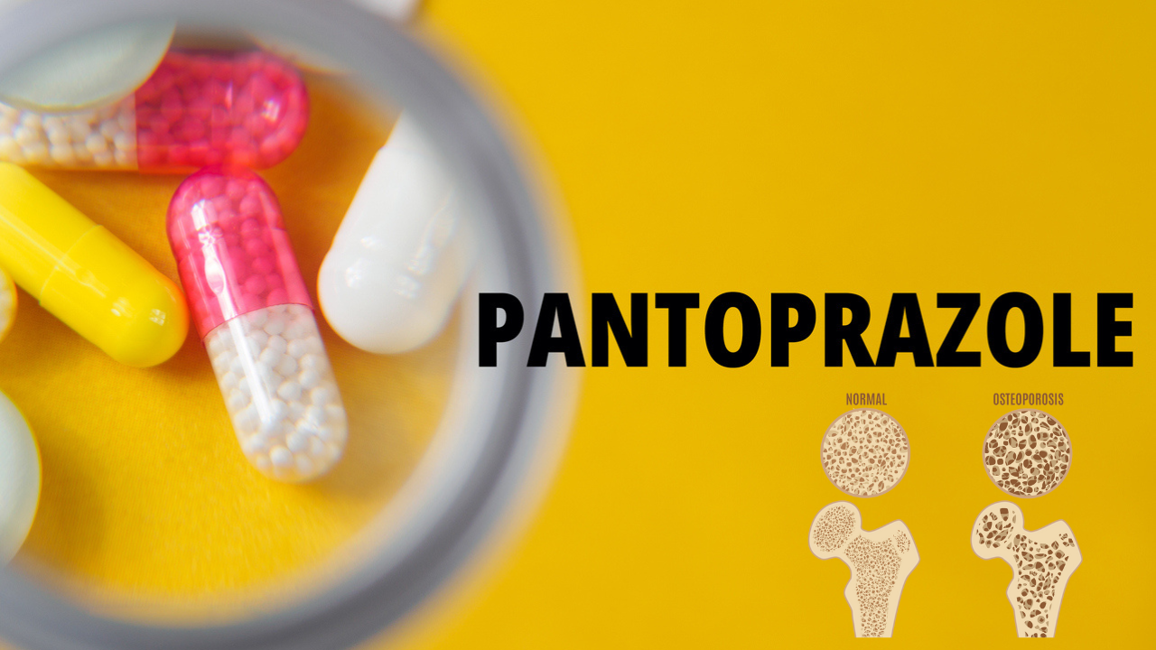 This Common Heartburn Medicine Causes Bone Loss And Fractures, According To Doctor; Here Are Safer Alternatives