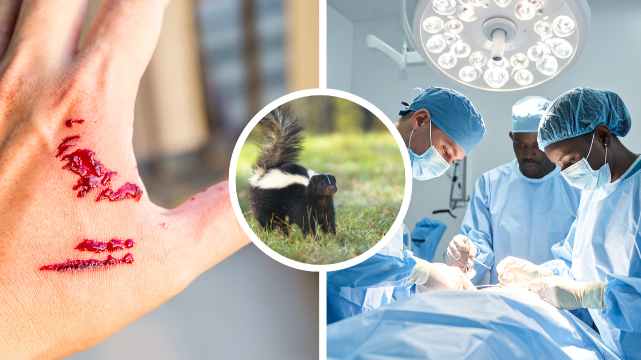 Diagnostic Anomaly: In An 'Exceptionally Rare' Case, Man Dies Of Rabies After Kidney Transplant