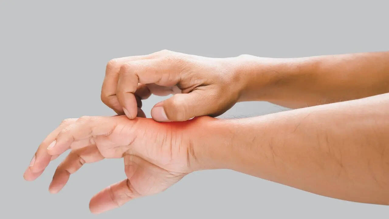 Do You Have Persistent Itching? It Could Be Linked To These 4 Cancers