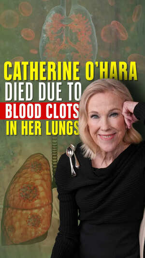 Catherine O’Hara Died Due To Blood Clots In Her Lungs