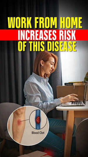 Work From Home Increases Risk Of This Disease