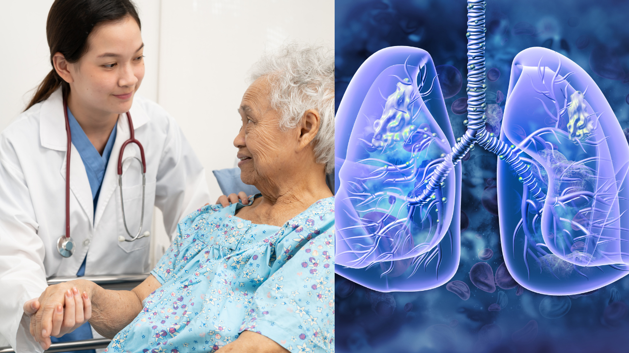 Mount Sinai Study Finds Lung Cancer Surgery Safe for Many Patients Over 80