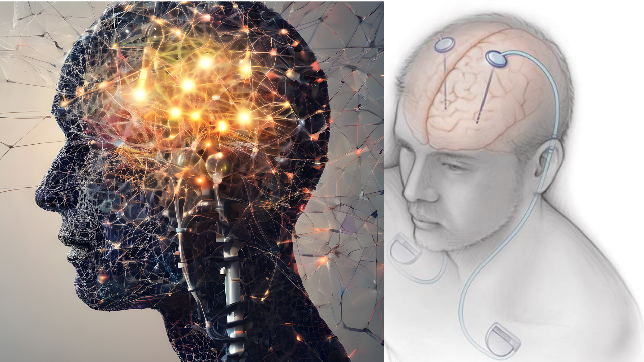 Deep Brain Stimulation for Parkinson’s: Restoring Movement and Independence