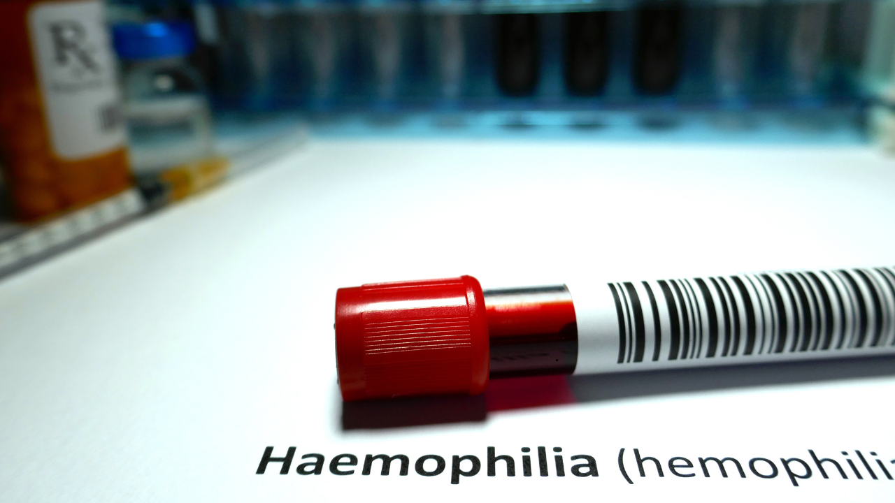 Why Hemophilia Care in India Lags Behind Globally, Expert Reveals: World Hemophilia Day