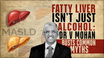Fatty Liver Isn’t Just Alcohol: Dr V Mohan Busts Common Myths