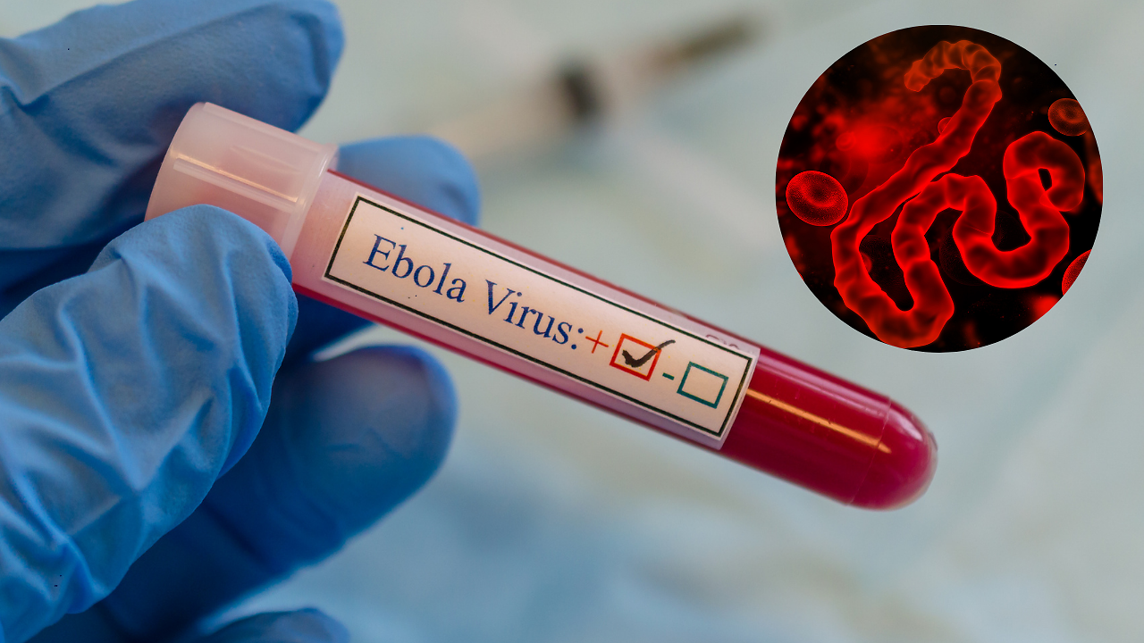 Update: Brazil Starts Investigation On Possible Ebola Infection, 37 ...