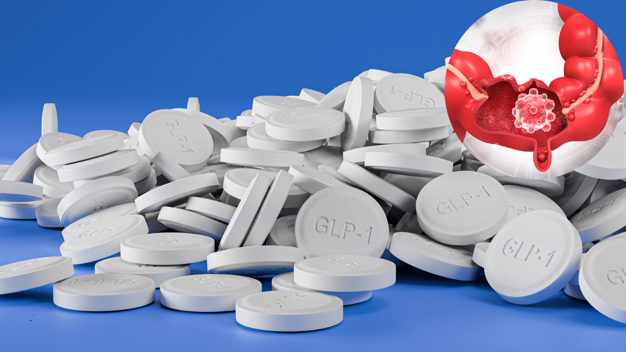 z pack and semaglutide Semaglutide, Other GLP-1 Drugs Linked to Lower Colorectal Cancer Risk:  Study