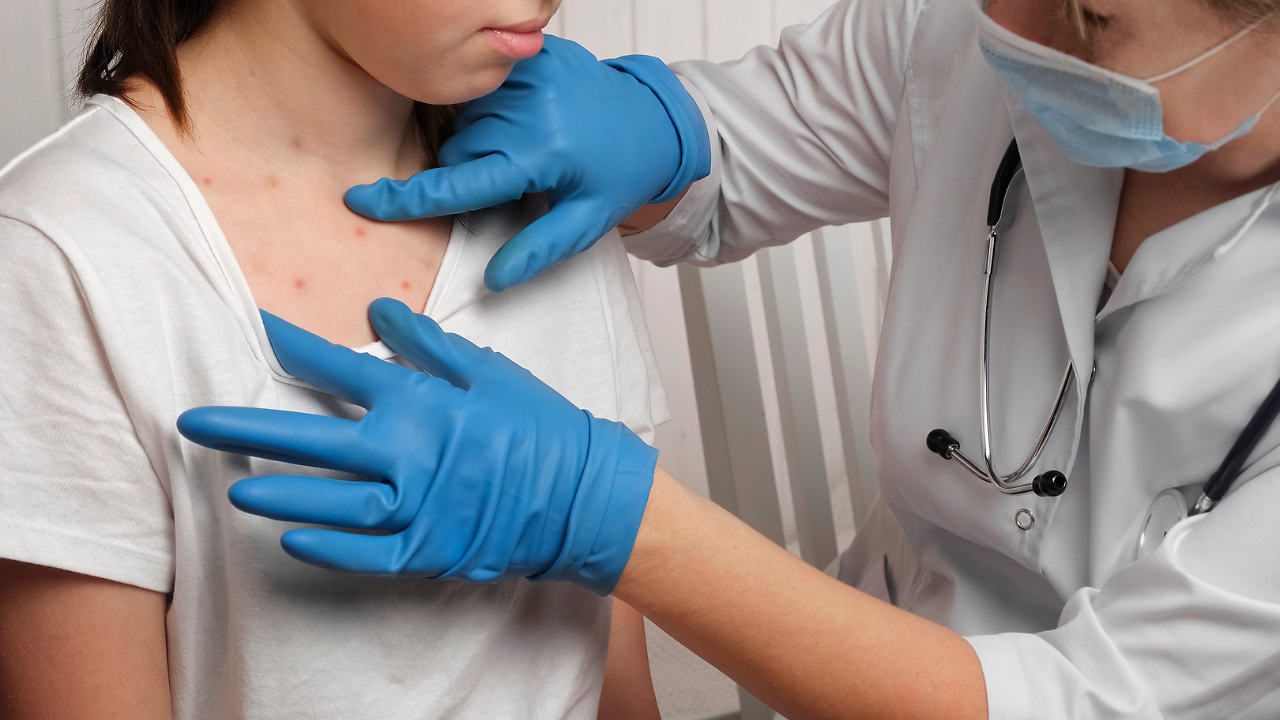 Another Child Dies From Measles In US Amid Vaccine Concerns: Why The ...