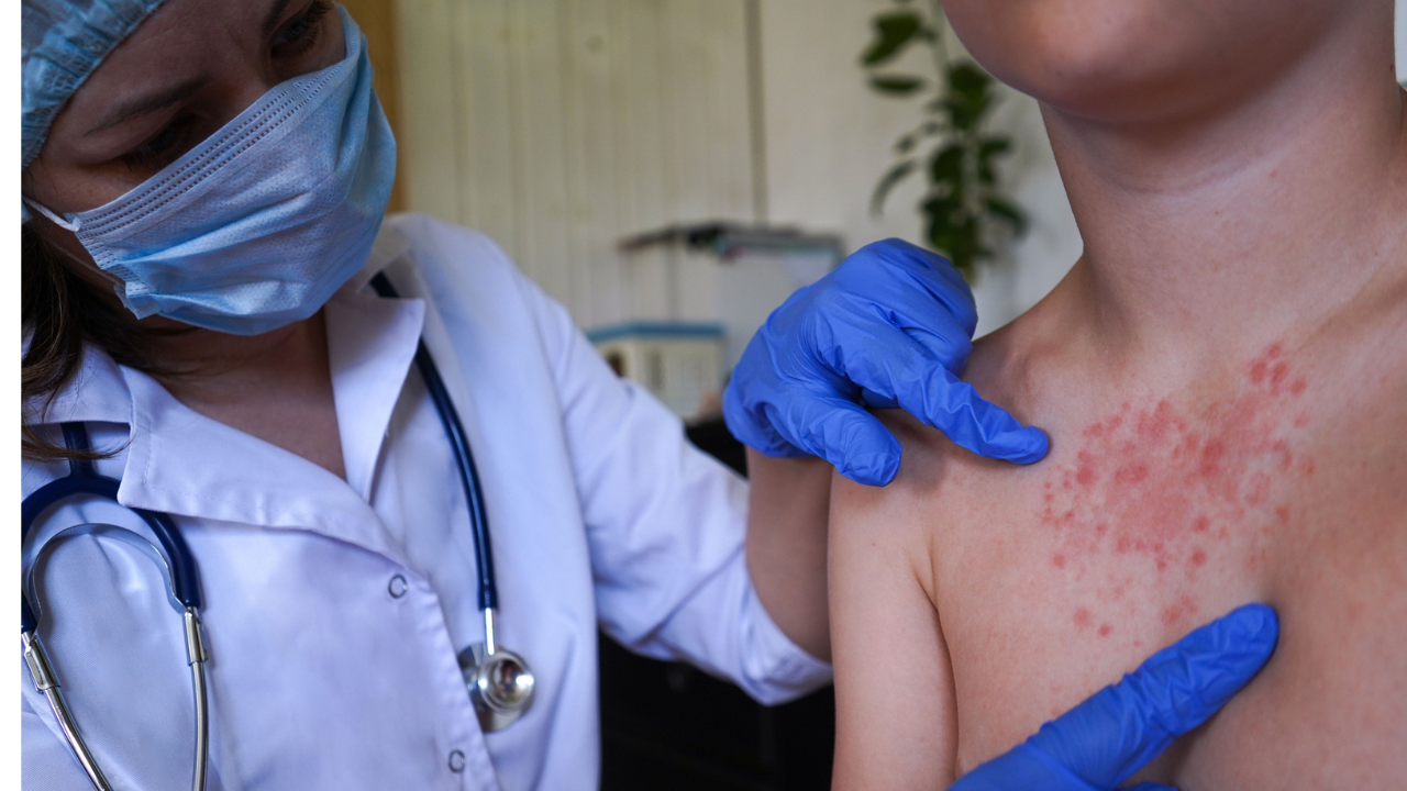 Nearly 1,000 Dead: Bangladesh, Once Close To Eliminating Measles, Is Now Facing The World's Worst Outbreak