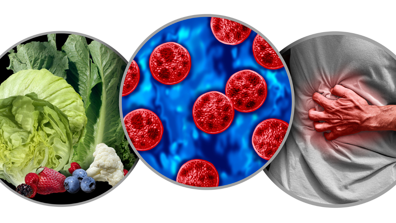 Biggest Cyclospora Outbreak In US Ends: After 13,000 Sick & 2 Dead, Lettuce Contamination Mystery Remains